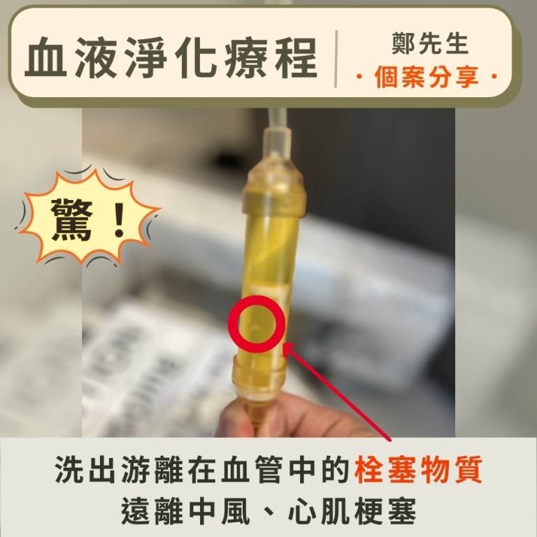 血液淨化可以洗出游離在血管中的栓塞物質，遠離中風以及心肌梗塞。